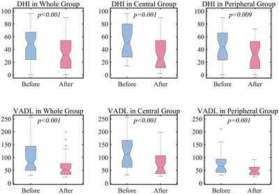 Efficacy of vestibular rehabilitation and its facilitating and hindering factors from real-world clinical data